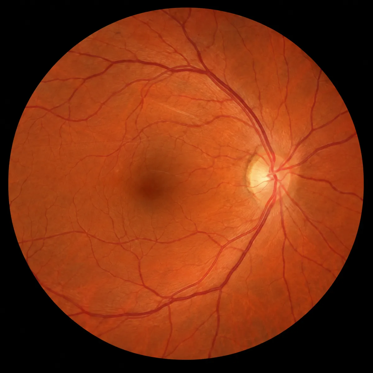 A photograph of a healthy retina